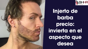 Read more about the article Injerto de barba precio: invierta en el aspecto que desea