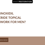 Does Minoxidil Finasteride Topical Really Work for Men?